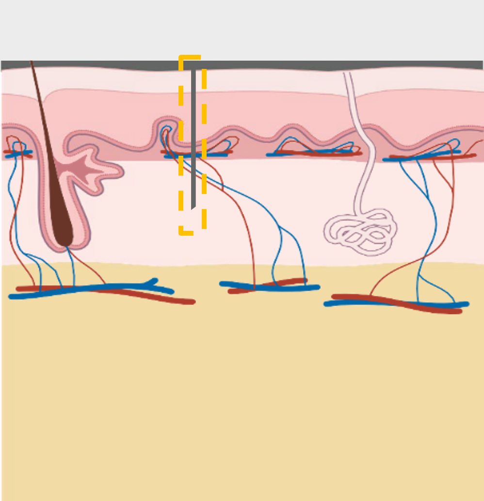 Dermis skin layer diagram